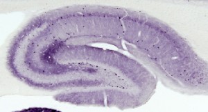Inmunorreactividad para la subunidad GABAB1 del receptor de GABAB en el hipocampo de la rata adulta mediante el uso del método de la inmunoperoxidasa a nivel de microscopía óptica. El receptor se expresa en el neuropilo de todas las capas dendríticas, así como en interneuronas (puntos oscuros).