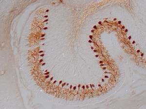 Inmunorreactividad para Calbindina, una proteína ligadora de Ca2+, en el cerebelo de una rata postnatal de 12 días de edad (P12), mediante el uso del método de la inmunoperoxidasa a nivel de microscopía óptica y contraste interdiferencial de Nomarski. La Calbindina se expresa en las células de Purkinje del cerebelo.